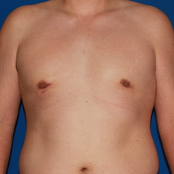 Male torso against a blue background.