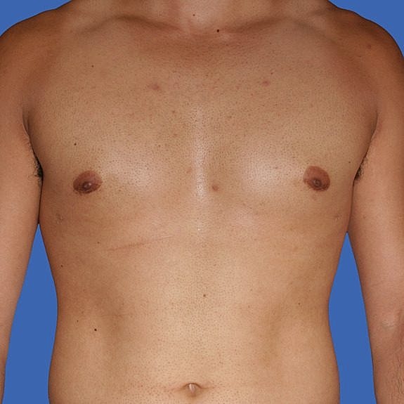 Male torso against a blue background.
