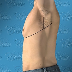 Anatomical image highlighting a male nipple.