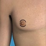 Anatomical image highlighting a male nipple.