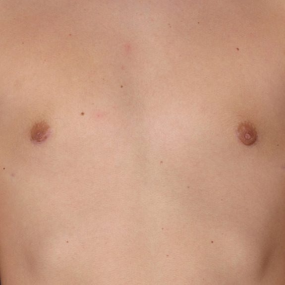 Male torso with visible nipples and skin tone.