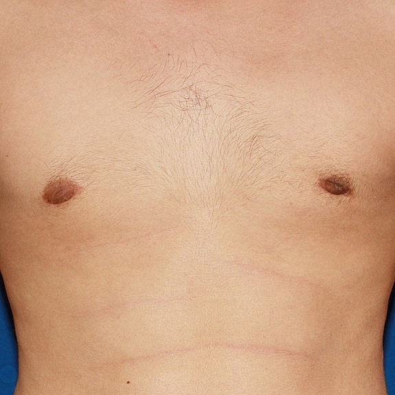 Male torso with visible chest and skin texture.
