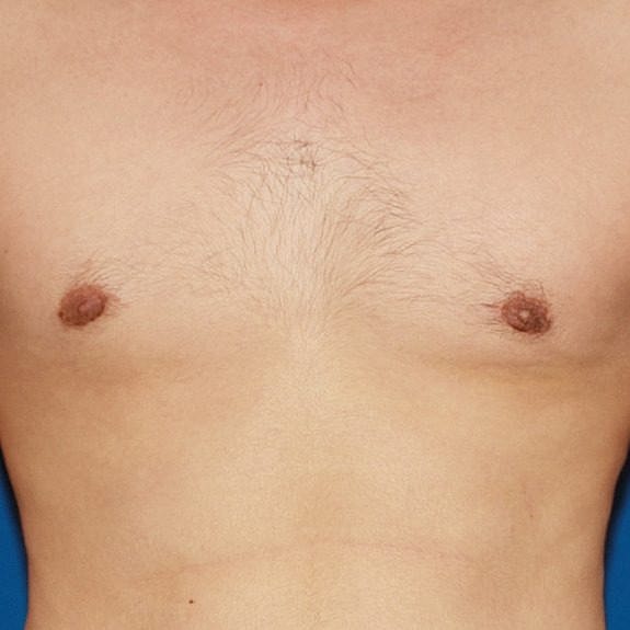 Male torso with chest hair and nipples.