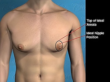 Nipple position reference for anatomical illustration.