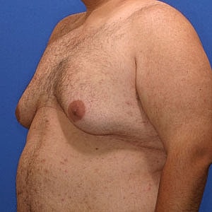 Side view of a bare torso against blue background.