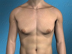 Anatomical male torso with neutral background.