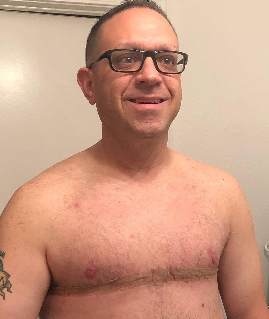 Man smiling, shirtless with band around chest.