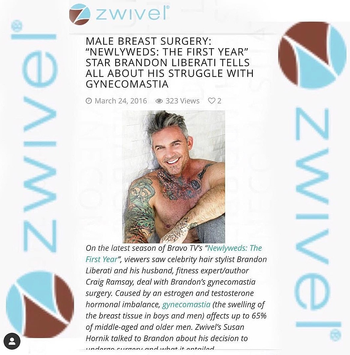Brandon Liberati discusses gynecomastia and surgery.