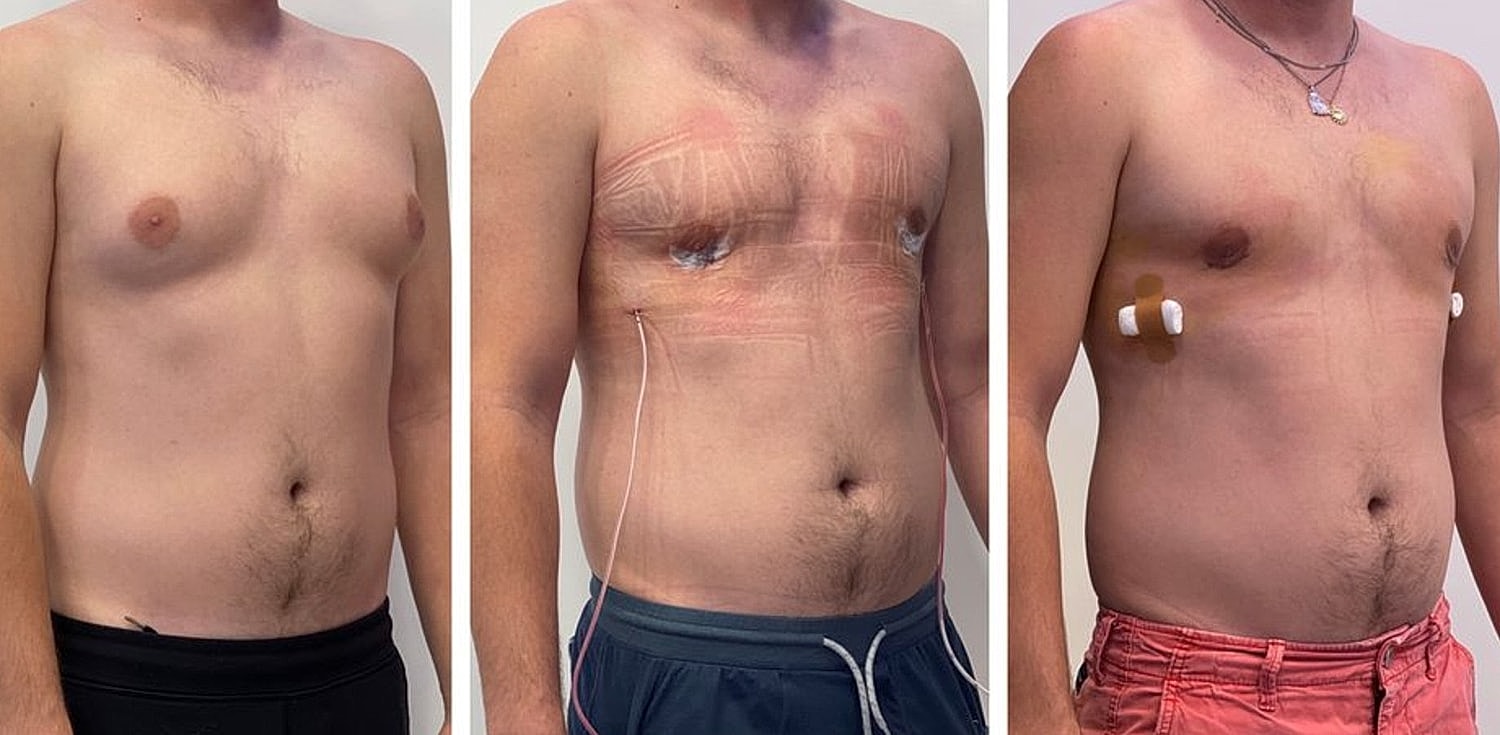 Patient status: before, during, and after treatment.