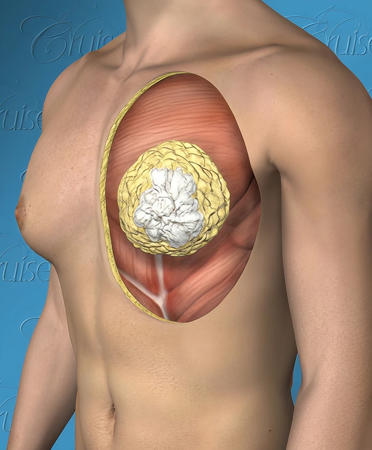 Anatomical illustration of human chest muscles.