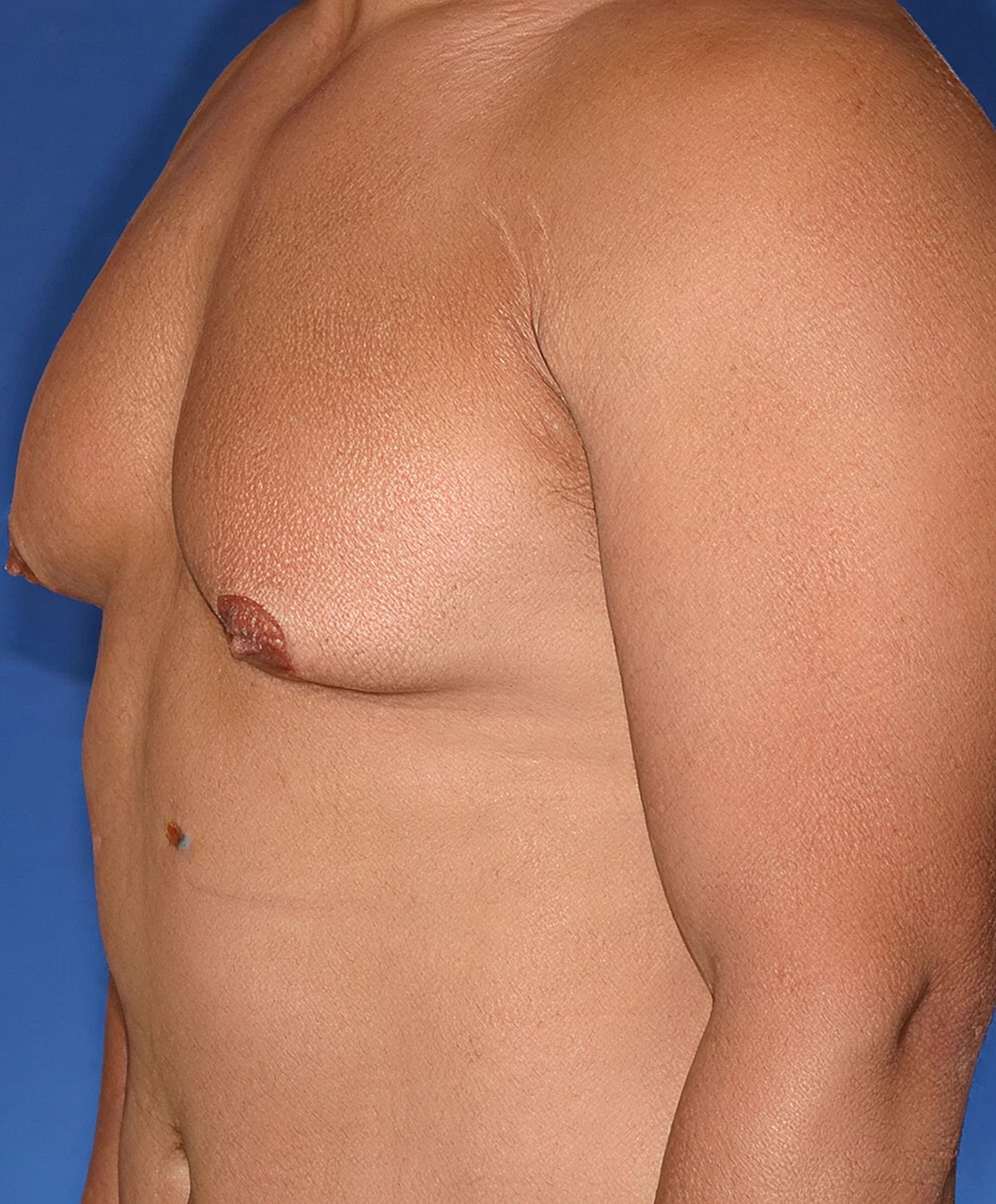 Male torso side view against blue background