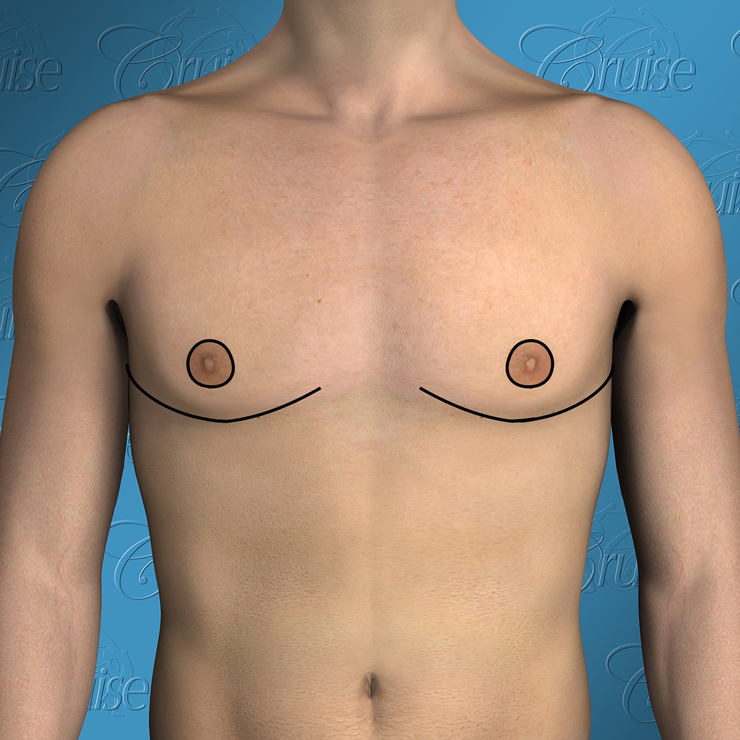 Male torso with no clothing displayed.