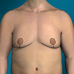 Male torso with no clothing displayed.
