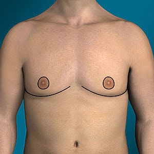 Human torso with outlined nipples.