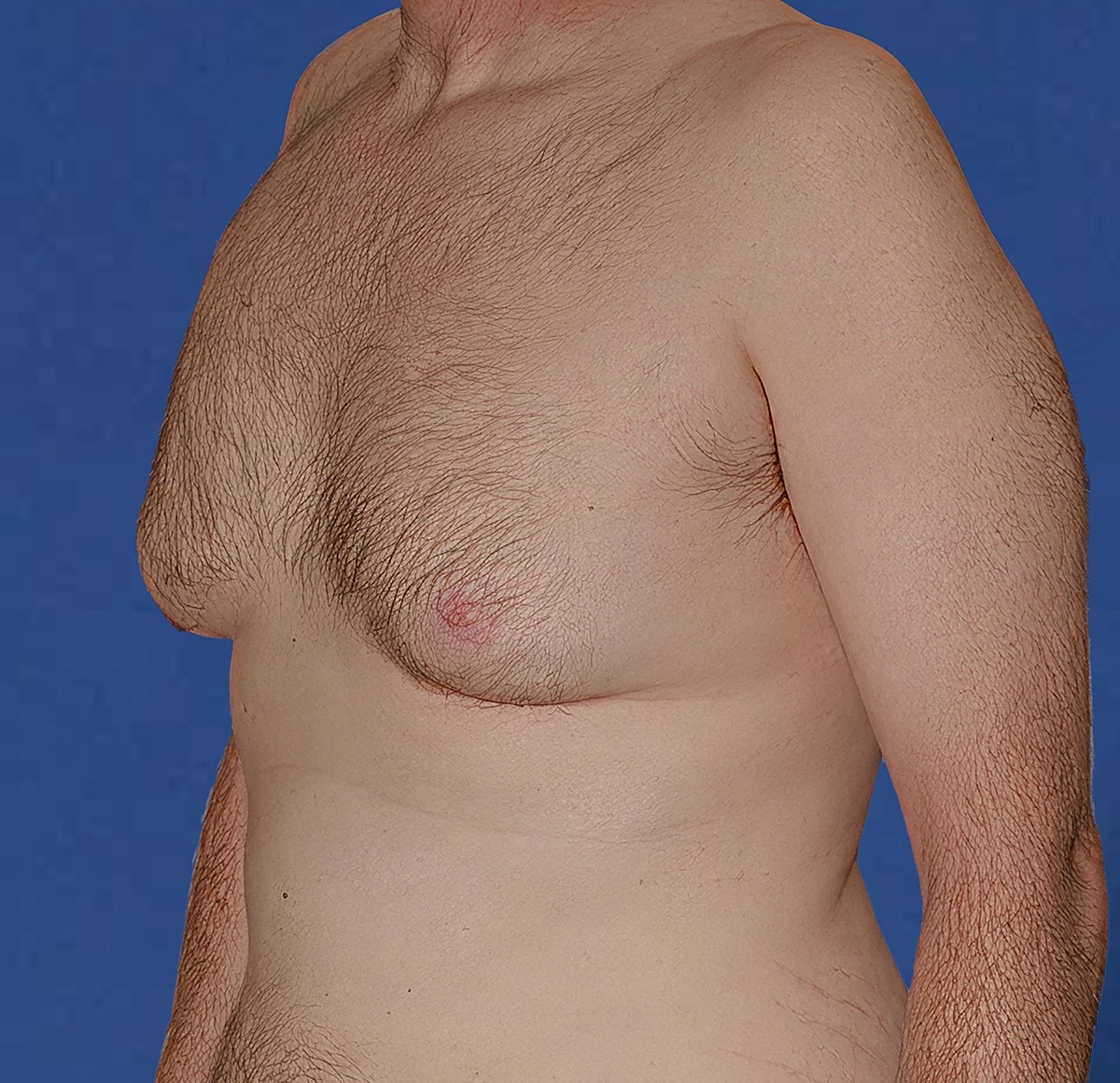 Man's upper body profile against a blue background.