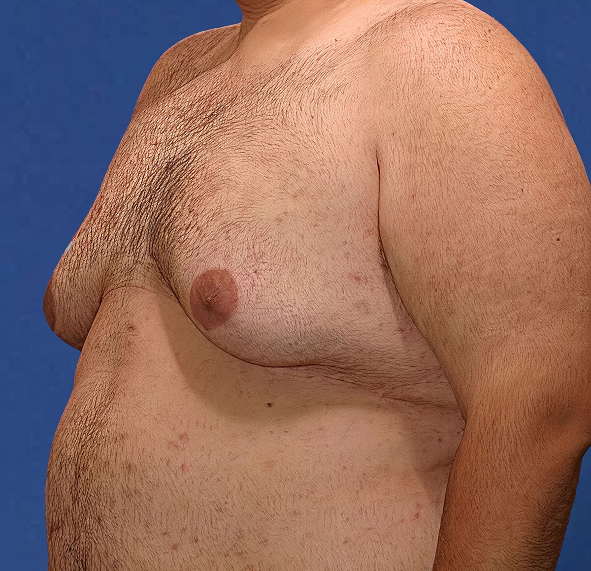 Side profile of a bare-chested person.