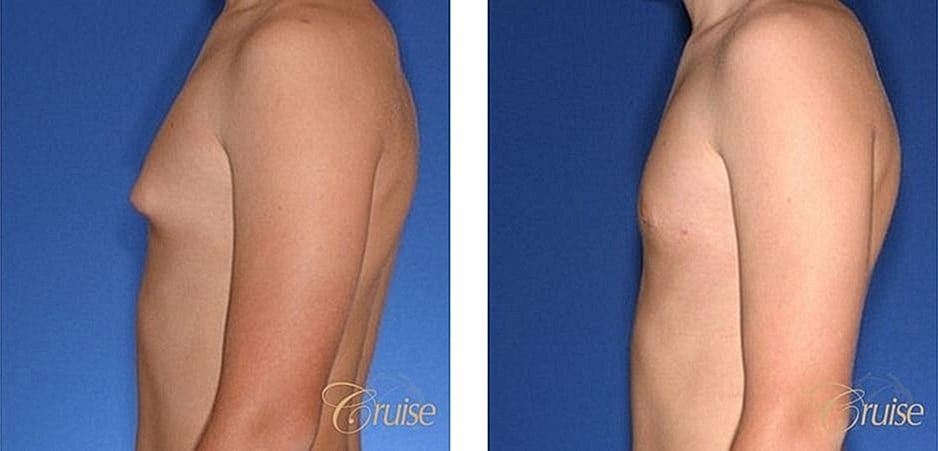 Before and after image of body transformation.