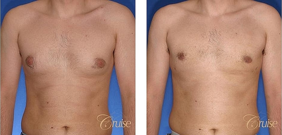 Before and after body transformation images.