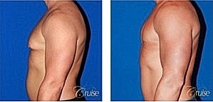 Before and after body image transformation comparison.