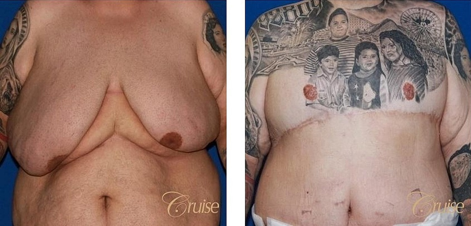Before and after body transformation images.