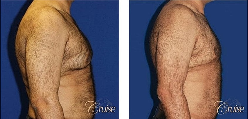 Before and after male torso transformation.
