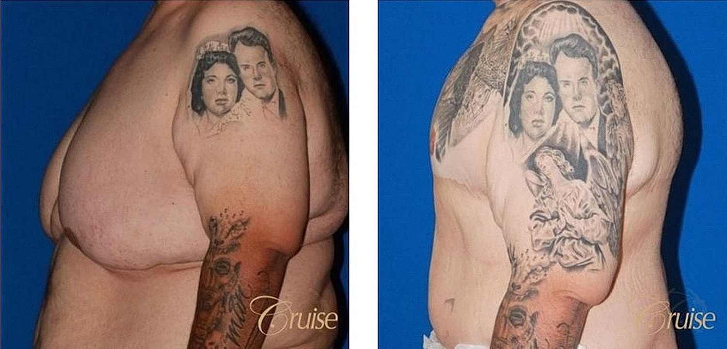 Before and after tattoo transformation on arm.