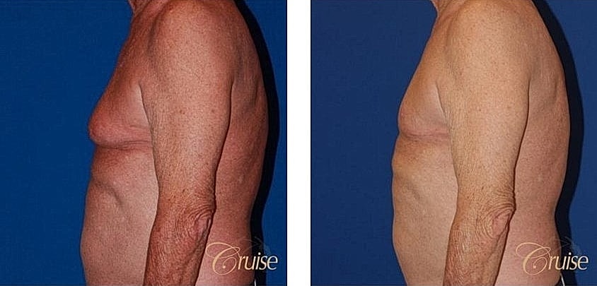 Before and after male body transformation comparison.