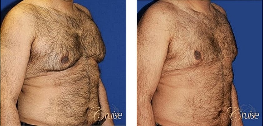 Before and after body transformation images.