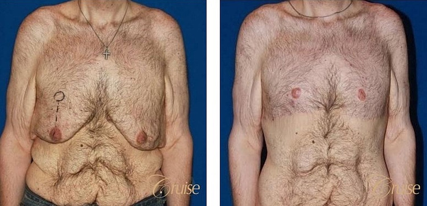 Before and after body transformation photos.