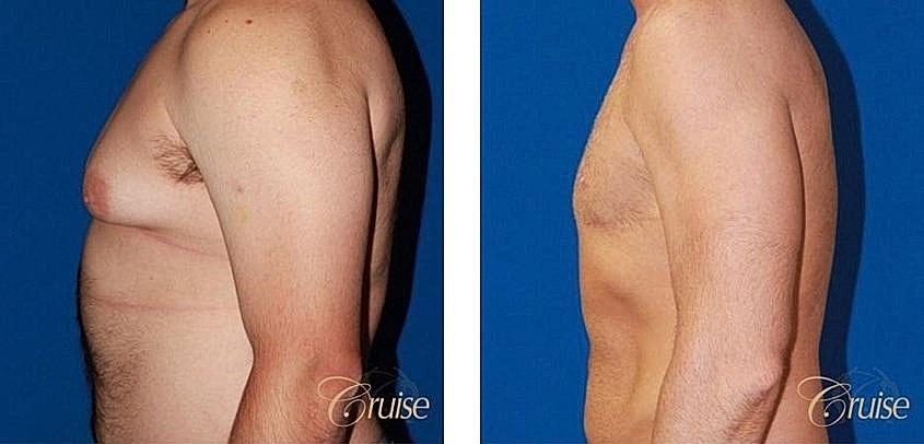 Before and after body transformation photos.