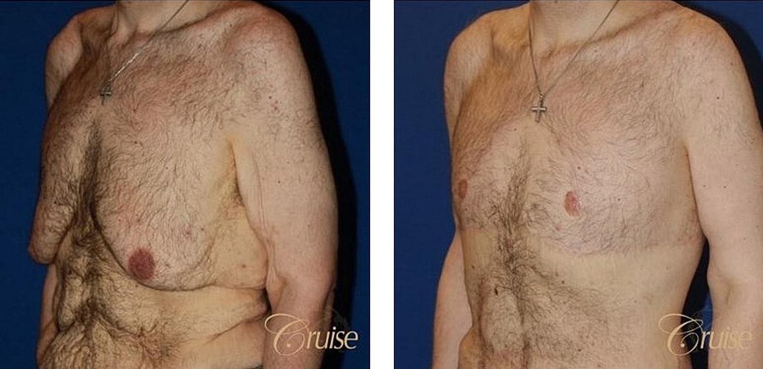 Before and after body transformation comparison.