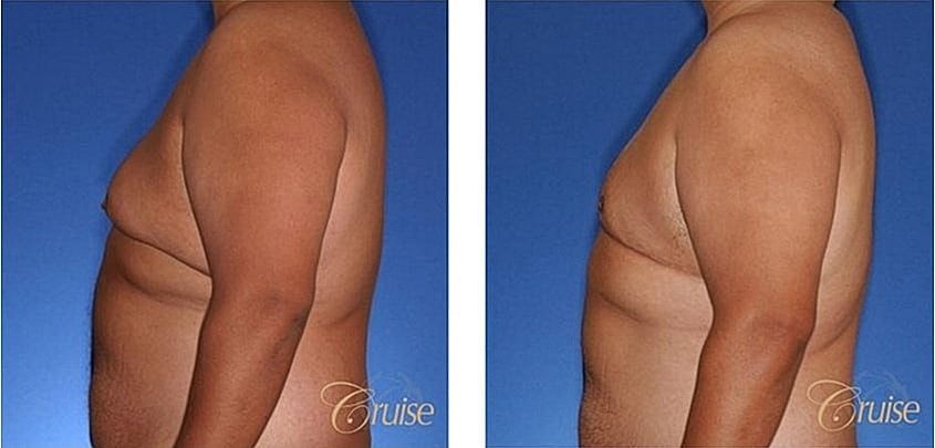 Before and after body transformation imagery