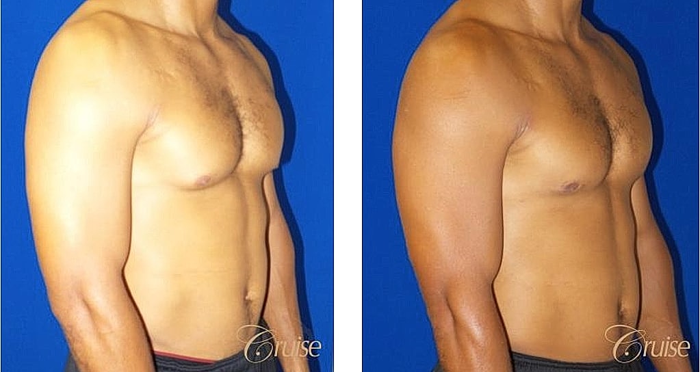 Before and after body transformation comparison.