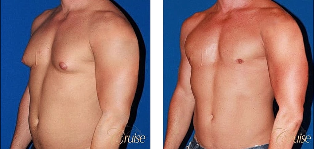 Before and after body comparison image