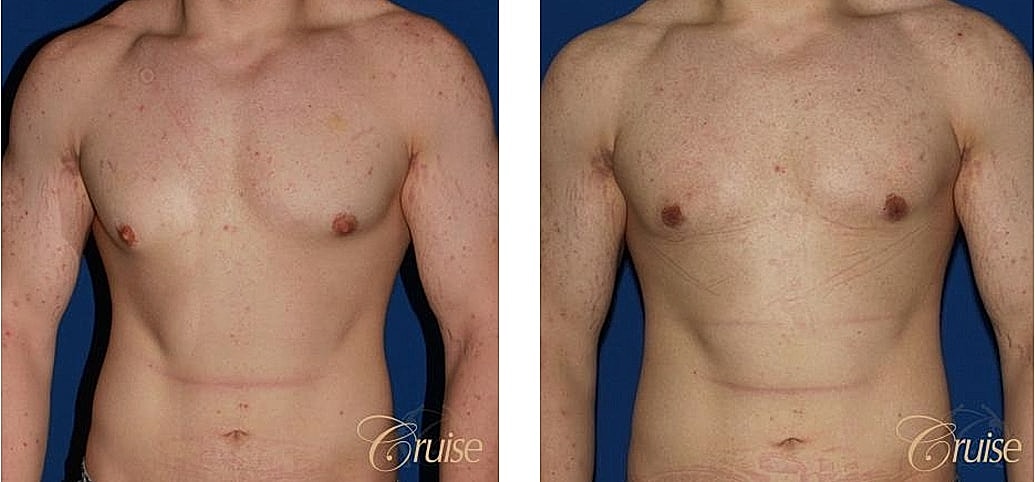 Before and after body transformation images