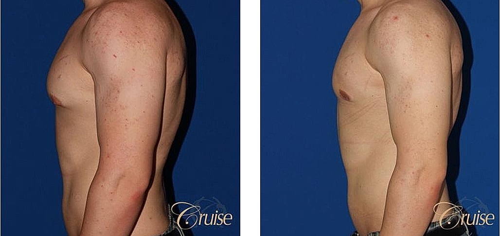 Before and after body transformation comparison image.