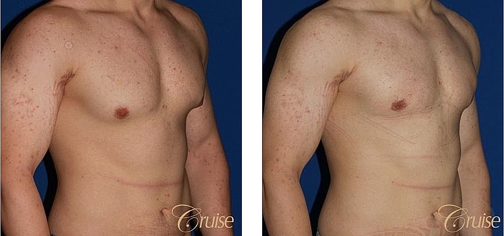 Before and after body transformation photos.