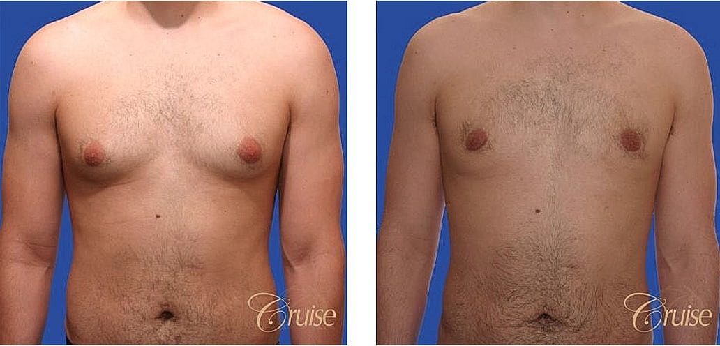 Before and after male body transformation photos.