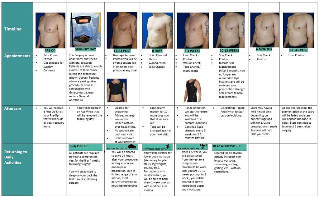 Post-surgery recovery timeline and care instructions.