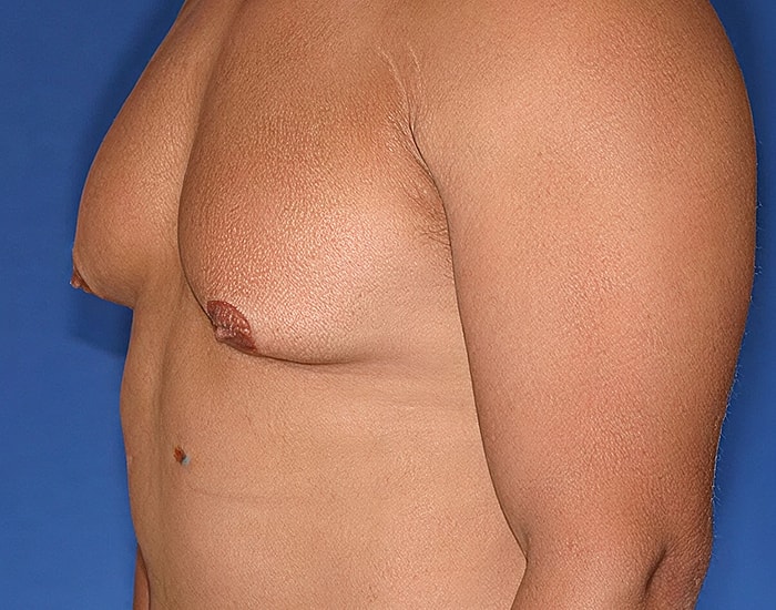 Side profile of a male torso.