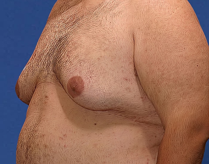 Side view of a male torso with hair.