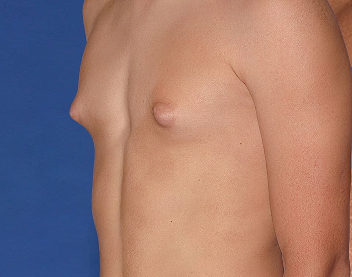 Side view of a person's torso without shirt.